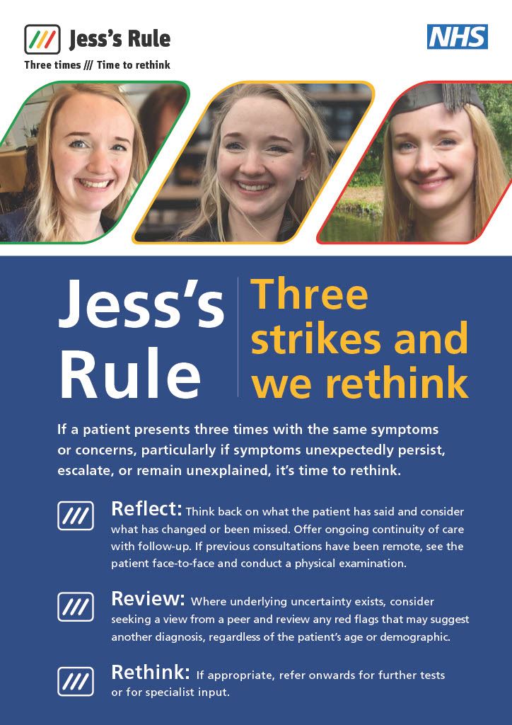 Jess